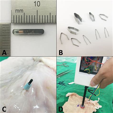 radio frequency rf tag|radio frequency tag localization lumpectomy.